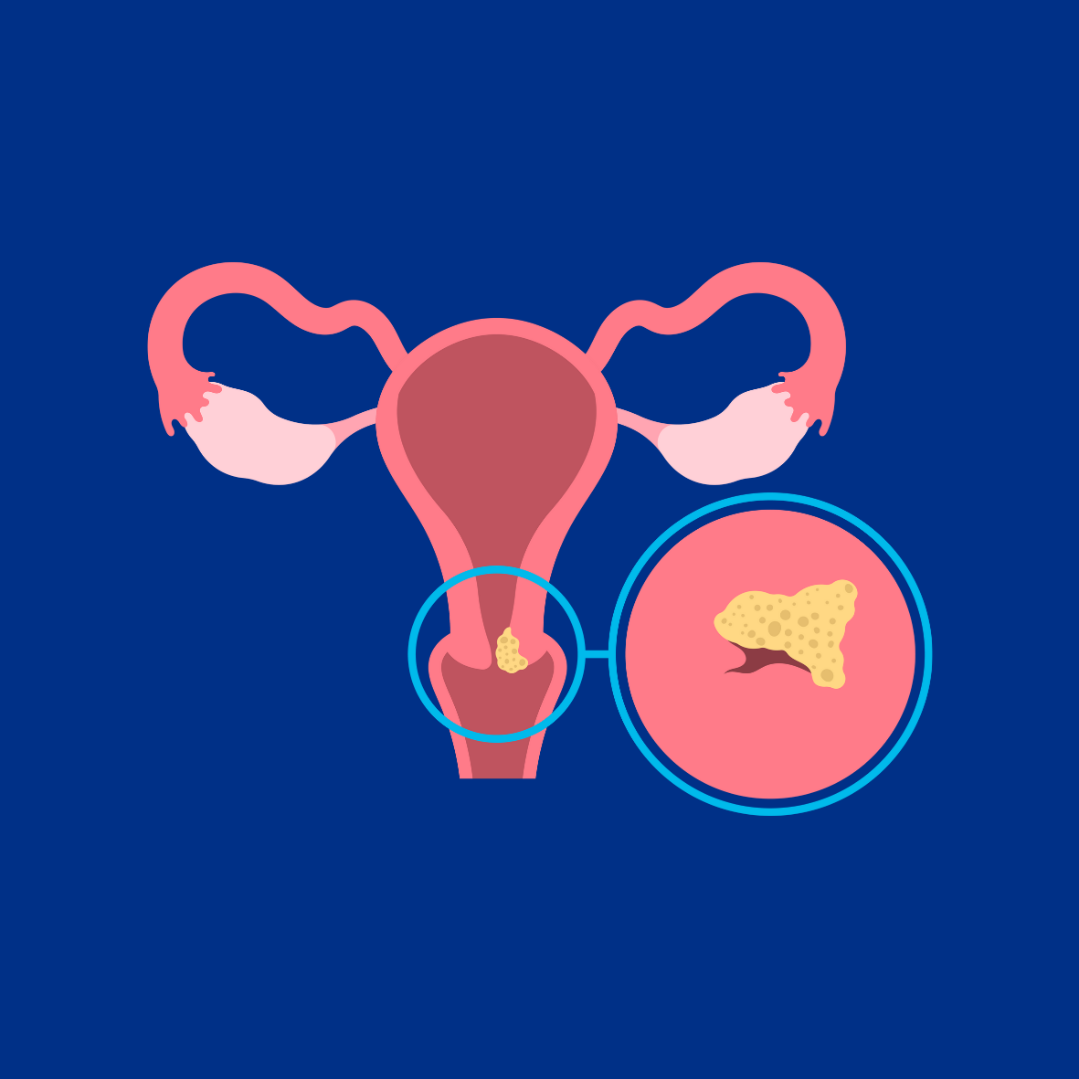 Image of Cervix