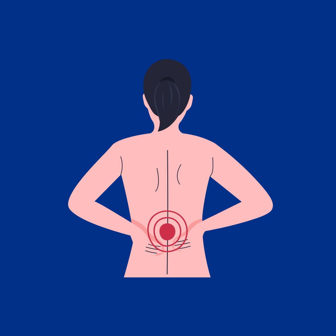 Image of a Person's Back Showing Radiating Back Pain