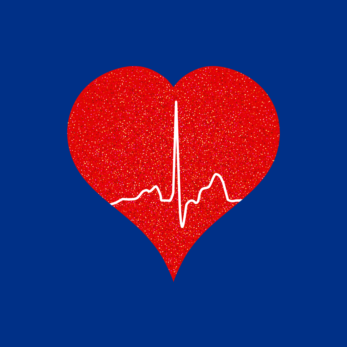 A Heart and Monitor Symbol to Represent Atrial Fibrillation